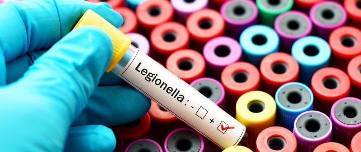 Legionella Testing Market Size, Share, Growth, Trends and Forecast 2024-2032