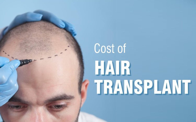 Hair Transplant cost in Mumbai