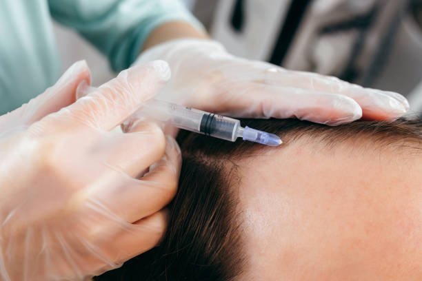 Dubai's Answer to Thinning Hair: Plasma Injections Redefine Beauty