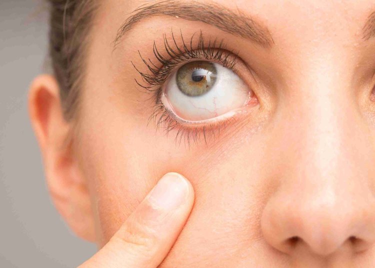 North America Dry Eye Syndrome Market Share, Size, Growth Analysis, & Report 2024-2032