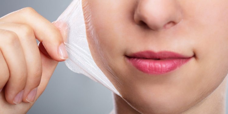 Transform Your Skin with Chemical Peeling in Dubai: A Comprehensive Overview