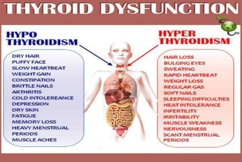 Thyroid Disorders: Homeopathic Treatment