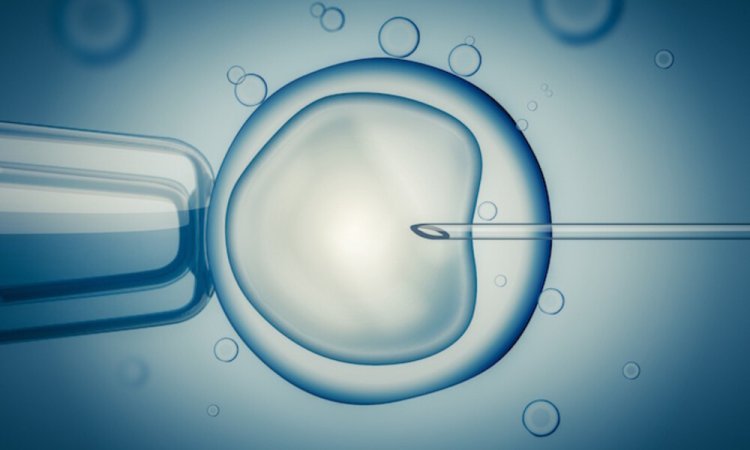 GCC In Vitro Fertilization (IVF) Market Growth Insights, Analysis, Industry Share, Size, and Forecast 2024-2032