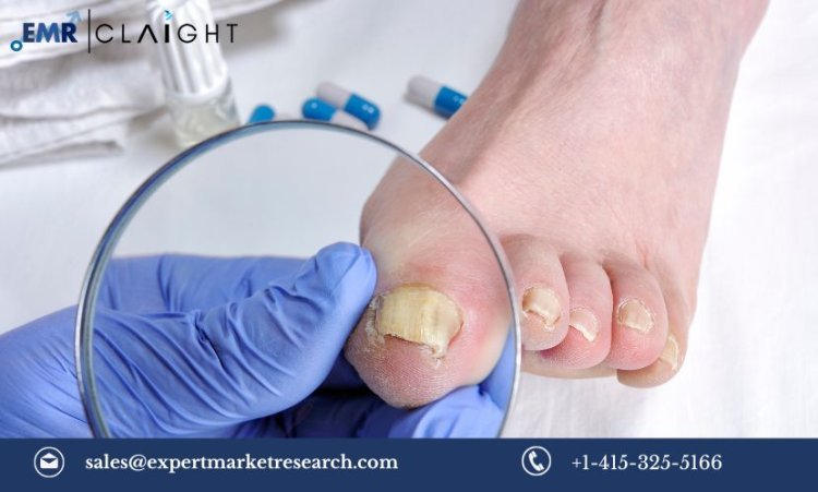 Onychomycosis Market Growth, Size, Share, Trends, Report 2024-2032