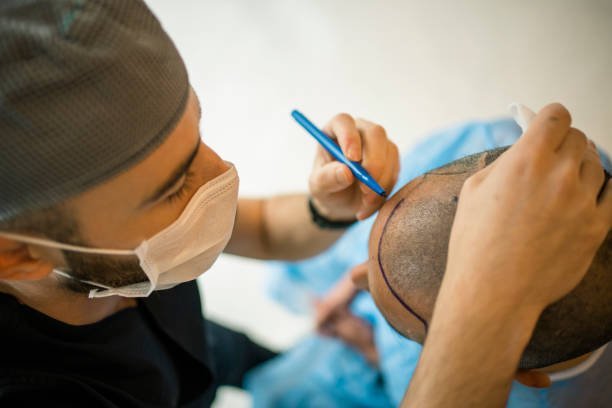 Hair Loss Solutions: Exploring Hair Transplant Options in Dubai