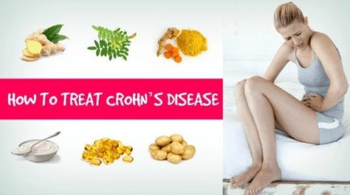 Safe and Natural Treatments for Crohn’s Disease 