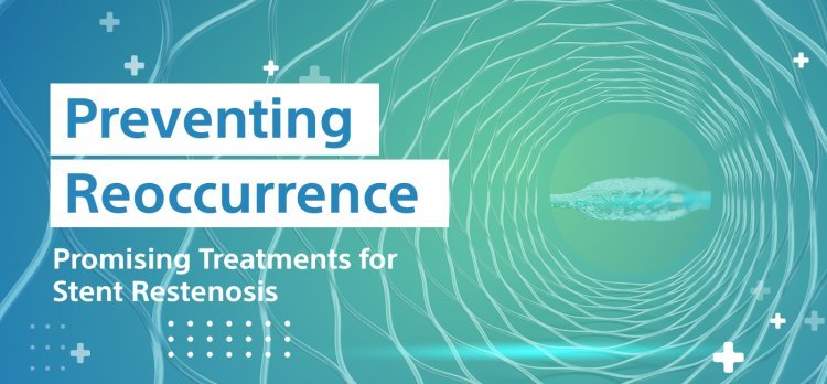 Preventing Reoccurrence: Promising Treatments for Stent Restenosis