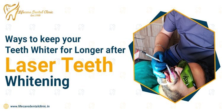 Ways to Keep Your Teeth Whiter For Longer After Laser Teeth Whitening in Chandigarh