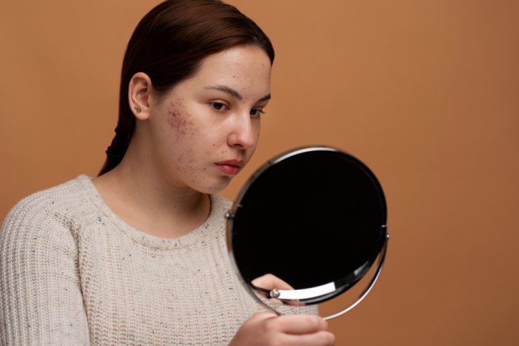 Unravelling Your Skin Problems: Surprising Causes of Your Skin Issues