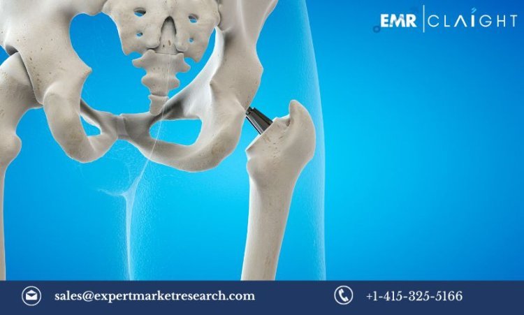 Orthopaedic Digit Implants Market Size, Share, Trends, Growth, Analysis & Report | 2032