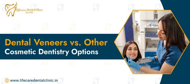 Dental Veneers vs. Other Cosmetic Dentistry Options
