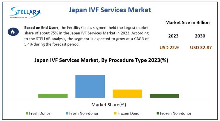 Japan In Vitro Fertilisation Service Market Size, Share Leaders And Research Statistics 2030