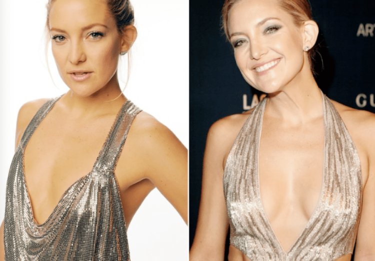 Celebrity Insights Stars Who Have Had Breast Augmentation