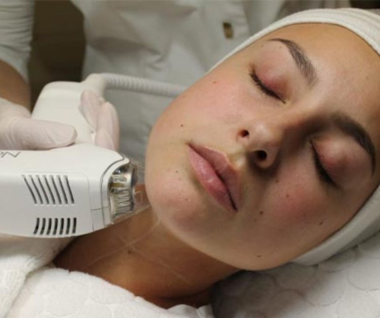 Experience Youthful Skin with Tixel Treatment at Allure Laser Studio
