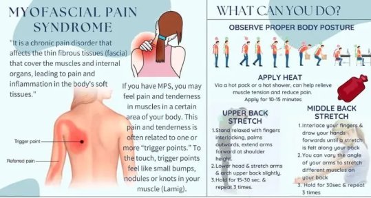 Myofascial Pain Syndrome: Symptoms, Causes, and Treatment  