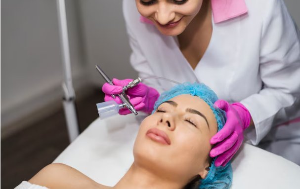 How A Microdermabrasion Facial In North York Can Improve Your Skin