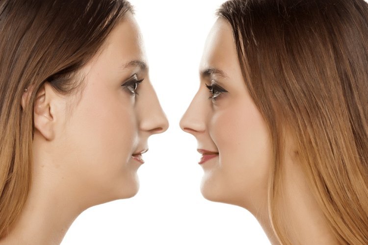 How to Search Top Rhinoplasty Surgeons in Dubai Finding the Best for Your Procedure