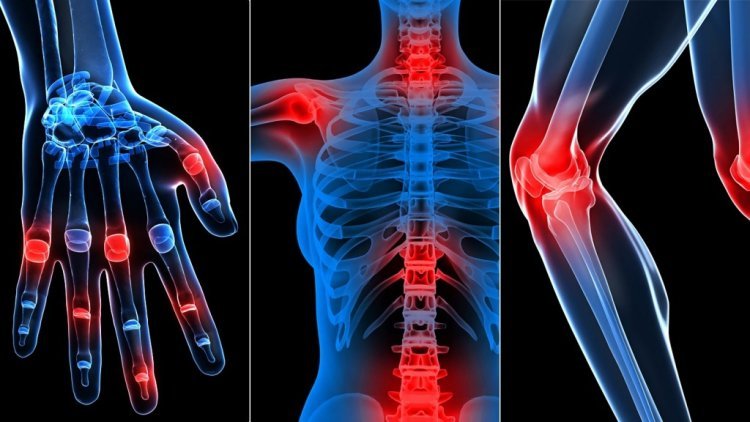 Arthritis Therapeutics Market: Exploring Emerging Opportunities for Growth