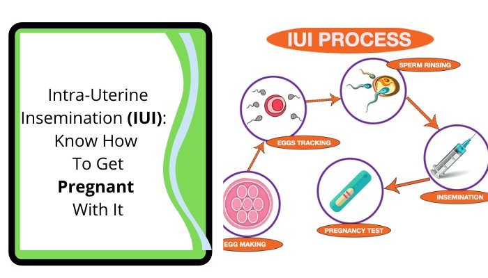 IUI Treatment in Lahore AustralianConcept Infertility Center