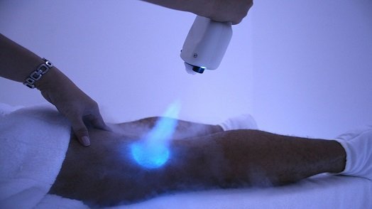 Does Cryotherapy Work for Pain and Muscle Recovery?