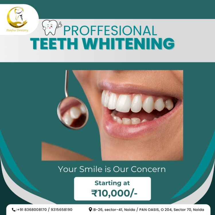 Professional Teeth Whitening in Noida | Complete Dental Solutions