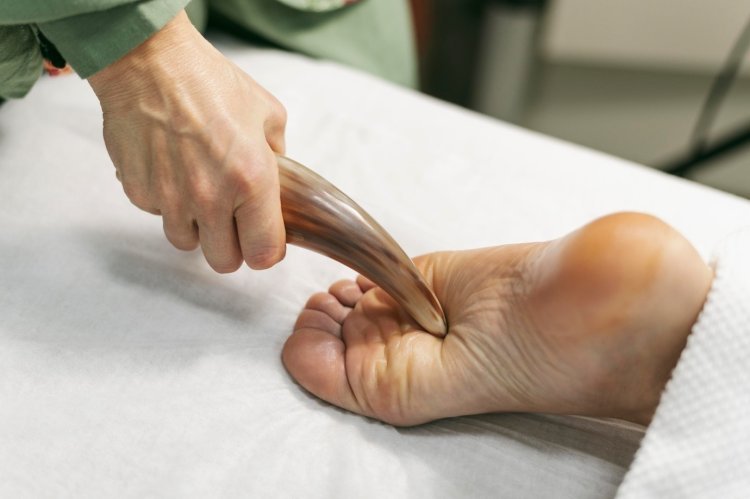 Can Acupuncture Speed Up Plantar Fasciitis Recovery? What Science Says