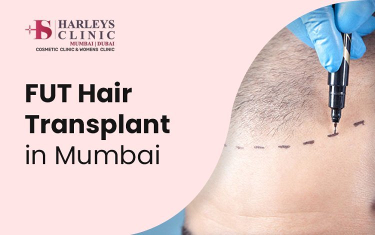 FUT Hair Transplant in Mumbai