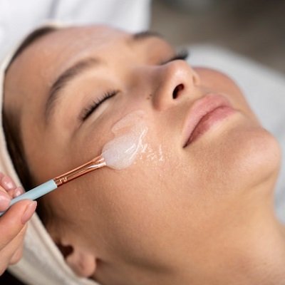 Cold Peel vs. Traditional Peels: Which One Is Right for You?