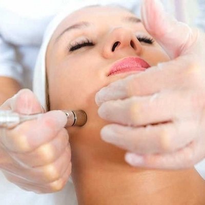 The Role of Microdermabrasion in Skin Brightening