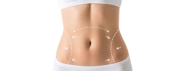 Achieve Your Ideal Body with Liposuction in Dubai