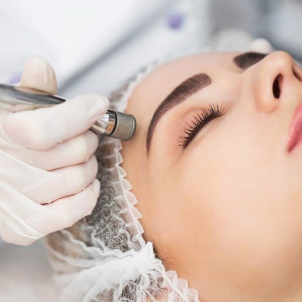 Can Microdermabrasion Prevent Premature Aging?